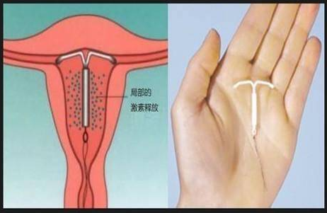 ��ԭ�ϭh(hu��n)ע�����,�ϭh(hu��n)�z��,�ϭh(hu��n)�ί�,