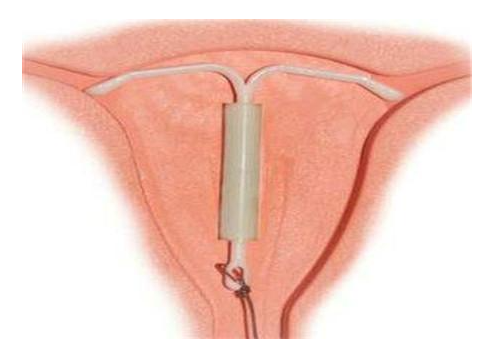 ��ԭ�ϭh(hu��n)ע�����(xi��ng),�ϭh(hu��n)�z��,�ϭh(hu��n)�ί�,